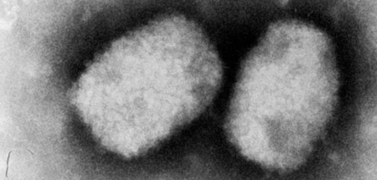 Eine elektronenmikroskopische Aufnahme zeigt das Affenpocken-Virus. (Archivbild: Keystone/DPA RKI/ANDREA MÄNNEL)
